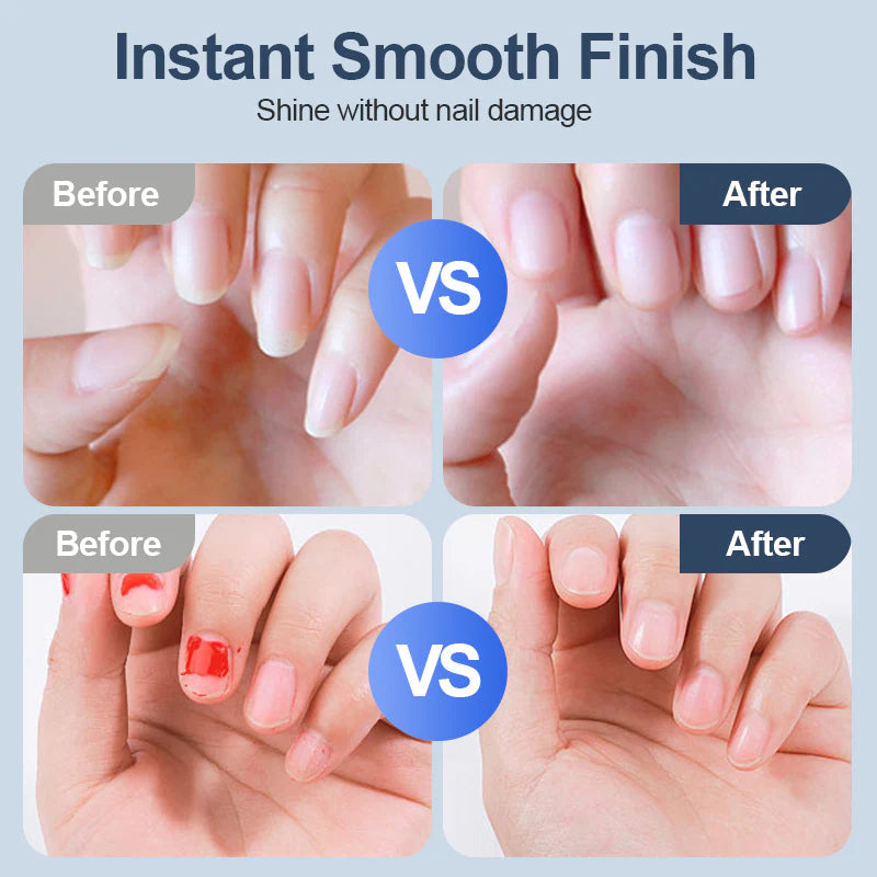 Electric Nail Clipper – Final 3 Hours: 60%OFF 🔥