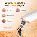 2026 Blackhead Remover Vacuum - Professional Blackhead Extractor for Face with 3 Adjustable Suction Levels, USB Rechargeable Pore Cleaner, and 5 Interchangeable Probes